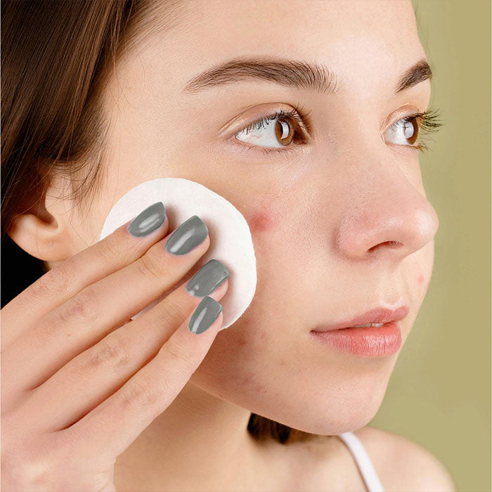 Koža sklona aknama: savjeti i trikovi za čistu kožu