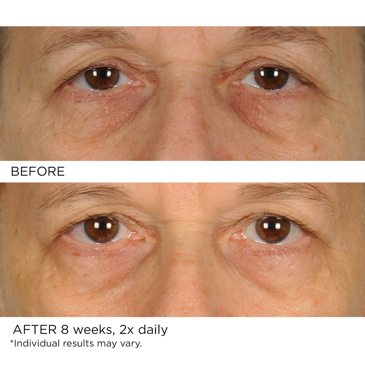 Undereye Anti-Aging Smoother