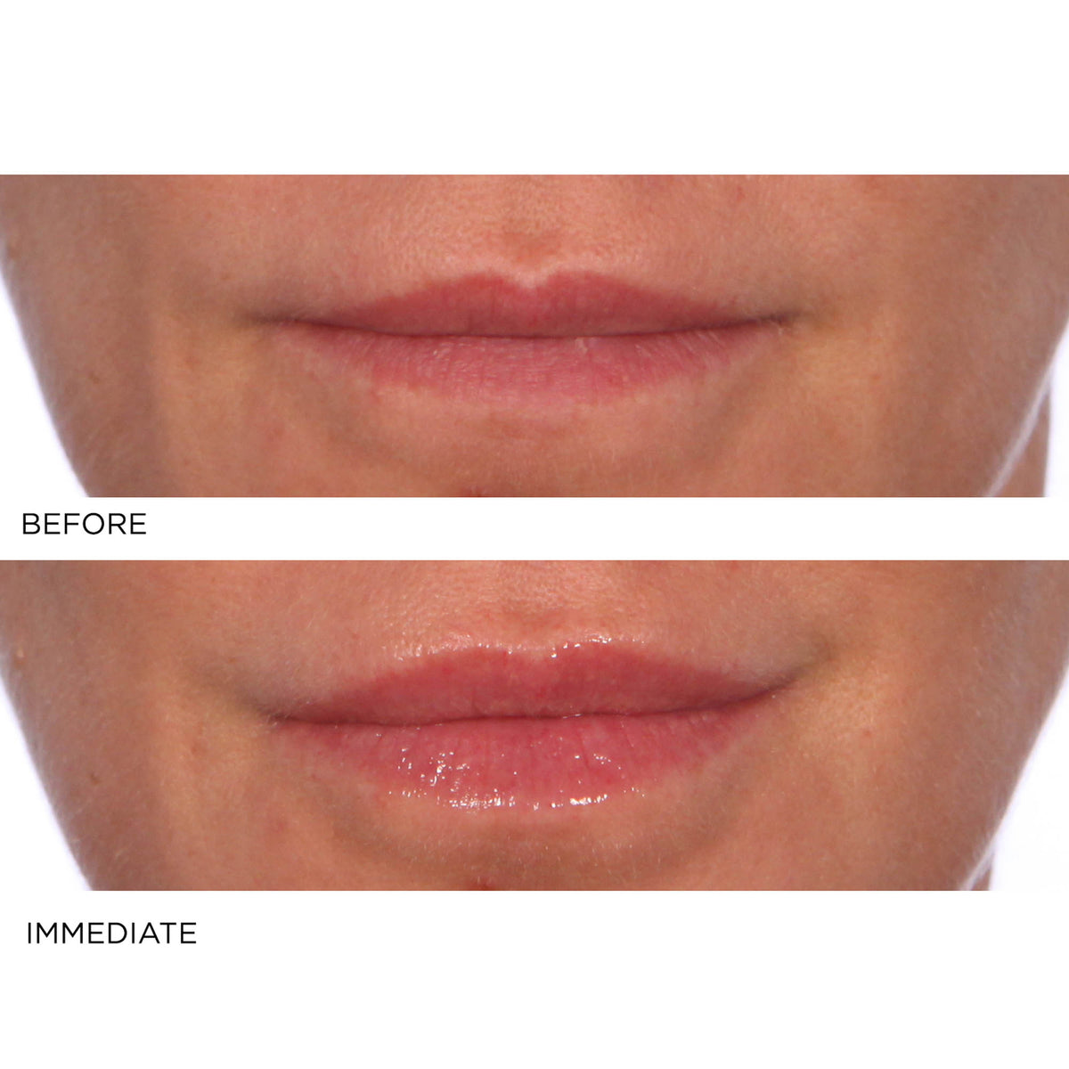 Hydro-screen For Lips