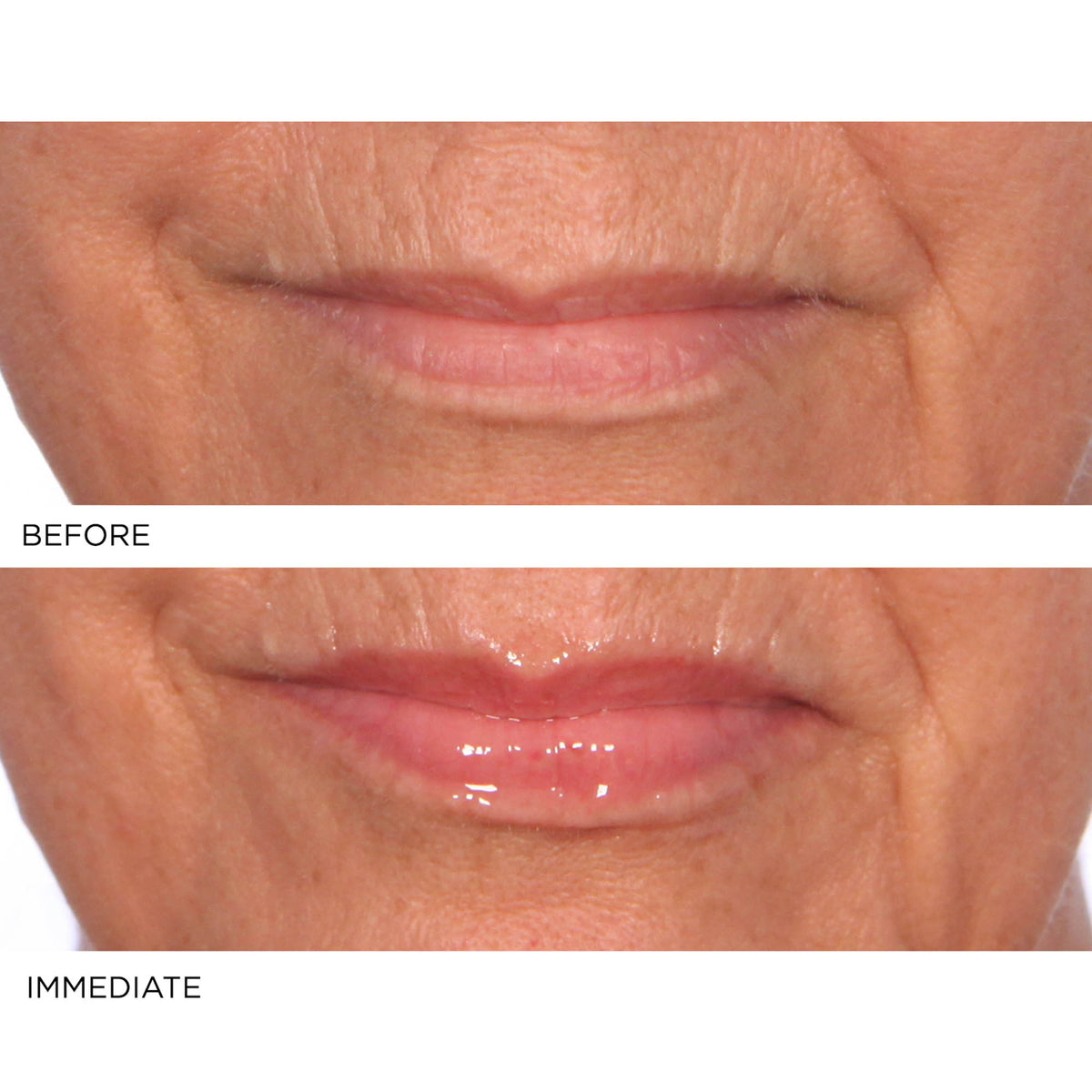 Hydro-Screen for Lips